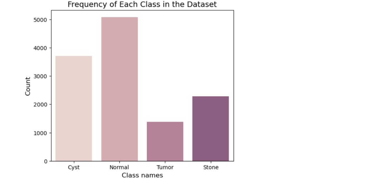 Kidney Disease Classification using CNN & VGG16 CNN GIF